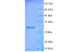 SDS-PAGE (SDS) image for Receptor (TNFRSF)-Interacting serine-threonine Kinase 1 (RIPK1) (AA 1-257), (full length) protein (His tag) (ABIN5713982) (RIPK1 Protein (AA 1-257, full length) (His tag))