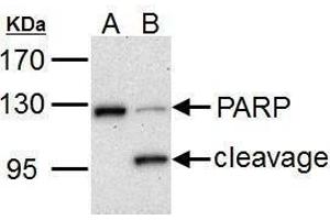 WB Image PARP1 antibody detects PARP1 protein by Western blot analysis. (PARP1 Antikörper)