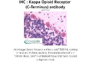 Image no. 1 for anti-Opioid Receptor, kappa 1 (OPRK1) (C-Term) antibody (ABIN1736160) (OPRK1 Antikörper  (C-Term))