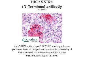 Image no. 1 for anti-Somatostatin Receptor 1 (SSTR1) (Extracellular Domain), (N-Term) antibody (ABIN1739669) (SSTR1 Antikörper  (Extracellular Domain, N-Term))