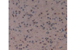 Used in DAB staining on fromalin fixed paraffin- embedded Kidney tissue (MEF2A Antikörper  (AA 1-160))