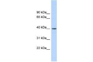 RAD51AP1 antibody used at 1 ug/ml to detect target protein. (RAD51AP1 Antikörper  (Middle Region))
