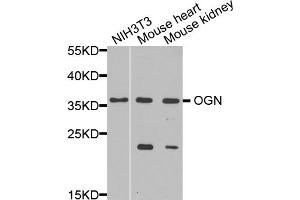 Western blot analysis of extracts of various cell lines, using OGN antibody. (OGN Antikörper)