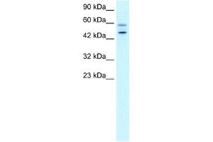 Human HepG2; WB Suggested Anti-DKFZP761C169 Antibody Titration: 0. (GC-Rich Promoter Binding Protein 1 (GPBP1) (N-Term) Antikörper)
