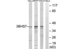 Western blot analysis of extracts from HeLa/MCF-7/COLO cells, using HSD3B7 Antibody. (HSD3B7 Antikörper  (AA 121-170))