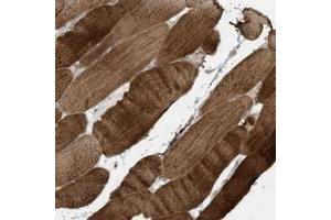 Immunohistochemical staining of human skeletal muscle with MB21D1 polyclonal antibody  shows strong cytoplasmic positivity in myocytes.