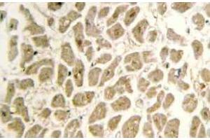 Immunohistochemistry (IHC) analyzes of Siah-2 antibody in paraffin-embedded human heart tissue. (SIAH2 Antikörper)