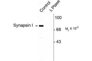 Image no. 1 for anti-Synapsin I (SYN1) (pSer9) antibody (ABIN372718) (SYN1 Antikörper  (pSer9))