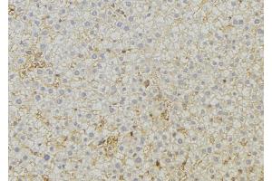 ABIN6279555 at 1/100 staining Mouse liver tissue by IHC-P. (ABCC6 Antikörper  (Internal Region))