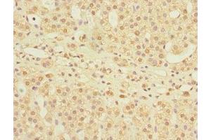 Immunohistochemistry of paraffin-embedded human adrenal gland tissue using ABIN7158982 at dilution of 1:100 (MPI Antikörper  (AA 1-423))