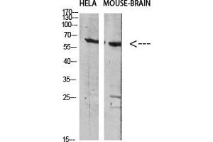 Western Blotting (WB) image for anti-GABA Transporter 1 (GAT1) antibody (ABIN5956621) (SLC6A1 Antikörper)