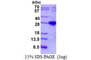 Josephin Domain Containing 1 (JOSD1) protein (His tag)