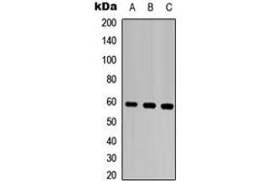Western blot analysis of MMP28 expression in HEK293T (A), Raw264.