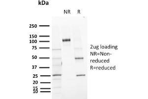SDS-PAGE Analysis Purified CD72 Mouse Monoclonal Antibody (BU40). (CD72 Antikörper)