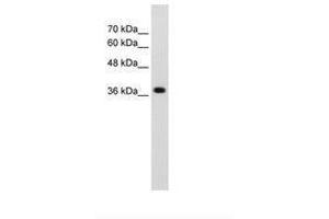 Image no. 2 for anti-LON Peptidase N-terminal Domain and Ring Finger 1 (LONRF1) (N-Term) antibody (ABIN203536) (LONRF1 Antikörper  (N-Term))