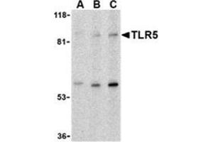 Western blot analysis of TLR5 in THP-1 cell lysate with this product at (A) 0. (TLR5 Antikörper  (C-Term))