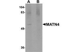 Western Blotting (WB) image for anti-Matrilin 4 (MATN4) (N-Term) antibody (ABIN1031453) (MATN4 Antikörper  (N-Term))