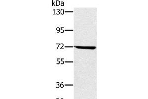 Western Blot analysis of Hela cell using NUP85 Polyclonal Antibody at dilution of 1:300 (NUP85 Antikörper)