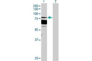 Western Blot analysis of PRKCB expression in transfected 293T cell line by PRKCB MaxPab polyclonal antibody. (PKC beta Antikörper  (AA 1-671))