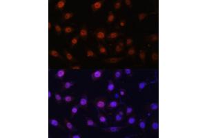 Immunofluorescence (IF) image for anti-Lysine (K)-Specific Demethylase 1A (KDM1A) (AA 130-380) antibody (ABIN7268323)