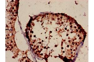 Immunohistochemistry (IHC) image for anti-H3 Histone, Family 3A (H3F3A) (AA 2-136) antibody (ABIN7155434)