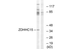 Western blot analysis of extracts from Jurkat cells, using ZDHHC15 antibody. (ZDHHC15 Antikörper  (C-Term))