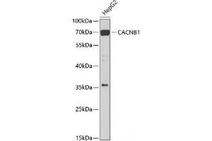 Western blot analysis of extracts of HepG2 cells using CACNB1 Polyclonal Antibody at dilution of 1:1000. (CACNB1 Antikörper)