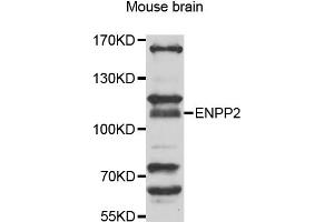 Western blot analysis of extracts of mouse brain, using ENPP2 antibody (ABIN5975354) at 1/1000 dilution. (ENPP2 Antikörper)