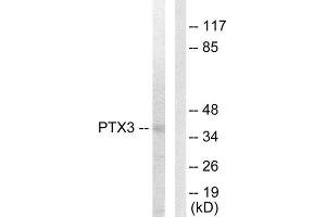 Western Blotting (WB) image for anti-Pentraxin 3 (PTX3) (N-Term) antibody (ABIN1849270) (PTX3 Antikörper  (N-Term))