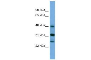 PPHLN1 antibody used at 0. (PPHLN1 Antikörper  (N-Term))