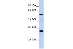 WB Suggested Anti-FAM83F Antibody Titration: 0. (FAM83F Antikörper  (Middle Region))