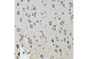 Immunohistochemistry of paraffin-embedded mouse brain using FGF2 antibody (ABIN5970065) at dilution of 1/100 (40x lens). (FGF2 Antikörper  (N-Term))