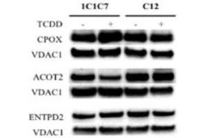 Western blot analysis of differentially expressed proteins identified by SILAC in hepatoma 1c1c7 and c12 cells exposed to DMSO or TCDD Source: PMID27105554 (ENTPD2 Antikörper  (AA 401-495))