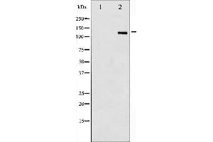 Western blot analysis of HDAC6 phosphorylation expression in NIH-3T3 whole cell lysates,The lane on the left is treated with the antigen-specific peptide. (HDAC6 Antikörper  (pSer22))