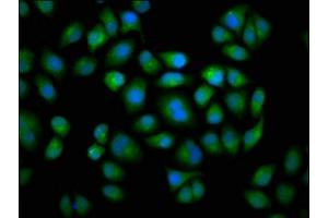 Immunofluorescence staining of Hela cells with ABIN7149243 at 1:133, counter-stained with DAPI. (CYP2C19 Antikörper  (AA 245-353))