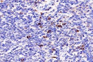 Immunohistochemistry analysis of paraffin-embedded human tonsil using,TCRb (ABIN7075813) at dilution of 1: 1800 (TCRb Antikörper)