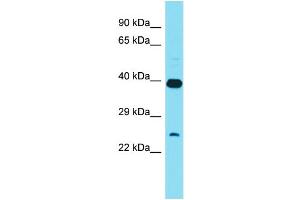 Host: Rabbit Target Name: XRCC6BP1 Sample Type: HT1080 Whole Cell lysates Antibody Dilution: 1. (XRCC6BP1 Antikörper  (C-Term))