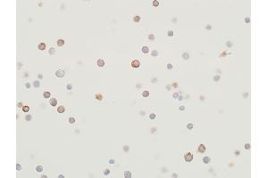 Immunocytochemistry (ICC) image for anti-Mitogen-Activated Protein Kinase Kinase 2 (MAP2K2) (AA 1-50) antibody (ABIN7454013) (Rekombinanter MEK2 Antikörper  (AA 1-50))