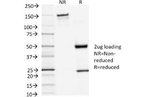 SDS-PAGE Analysis Purified TSH-Receptor, A-Chain Mouse Monoclonal Antibody (TSHRA/1402). (TSH receptor Antikörper)