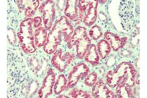 Human Kidney: Formalin-Fixed, Paraffin-Embedded (FFPE) (ANTXR2 Antikörper)