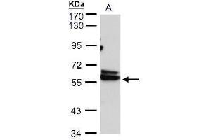 WB Image Sample(30 ug whole cell lysate) A:293T 7. (CCT4 Antikörper)