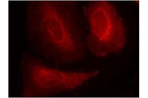 Image no. 3 for anti-3-phosphoinositide Dependent Protein Kinase-1 (PDPK1) (pSer241) antibody (ABIN196616) (PDPK1 Antikörper  (pSer241))