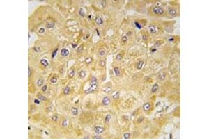 Immunohistochemistry (IHC) image for anti-Integrin-Linked Kinase (ILK) (AA 11-41) antibody (ABIN3031392)