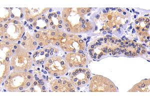 Immunohistochemistry (IHC) image for anti-Matrix Metallopeptidase 7 (Matrilysin, Uterine) (MMP7) (AA 1-267) antibody (ABIN7431014)