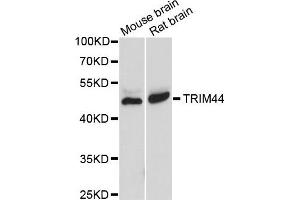 Western blot analysis of extracts of various cells, using TRIM44 antibody. (TRIM44 Antikörper)