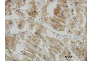 Immunoperoxidase of monoclonal antibody to COX17 on formalin-fixed paraffin-embedded human heart. (COX17 Antikörper  (AA 1-63))