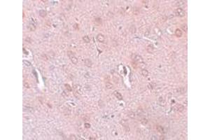 Immunohistochemistry (IHC) image for anti-Potassium Channel Subfamily K Member 18 (KCNK18) (Middle Region) antibody (ABIN1031143) (KCNK18 Antikörper  (Middle Region))