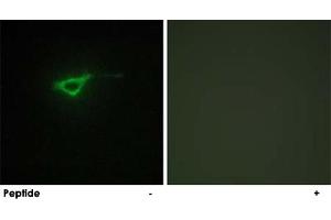 Immunofluorescence analysis of NIH/3T3 cells, using COL20A1 polyclonal antibody . (COL20A1 Antikörper  (C-Term))
