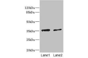 Western blot All lanes: EFNB3 antibody at 1. (Ephrin B3 Antikörper  (AA 28-226))