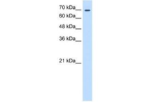 WB Suggested Anti-TGM2 Antibody Titration:  0. (Transglutaminase 2 Antikörper  (N-Term))